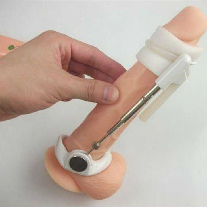 The extender helps to increase the size of the penis without creams